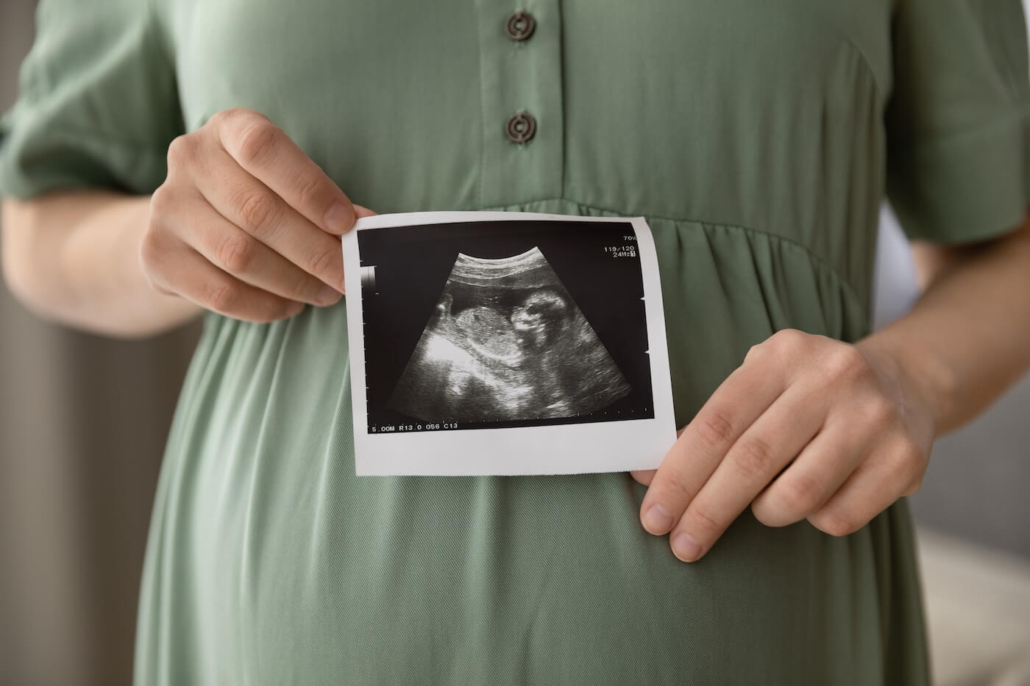 Prenatal ultrasound screening